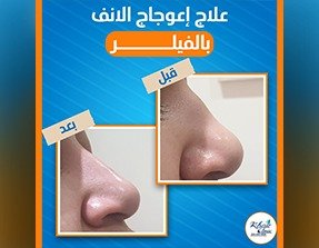 WhatsApp Image 2026-01-27 at 3.09.35 PM (5)