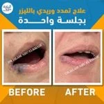 WhatsApp-Image-2026-01-27-at-3.09.34-PM-1-150x150
