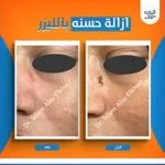 WhatsApp-Image-2026-01-27-at-3.09.35-PM-3-150x150