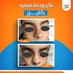 WhatsApp-Image-2026-01-27-at-3.09.35-PM-4-150x150