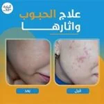 WhatsApp-Image-2026-01-27-at-3.09.35-PM-6-150x150