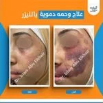 WhatsApp-Image-2026-01-27-at-3.09.35-PM-7-150x150
