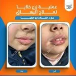 WhatsApp-Image-2026-01-27-at-3.09.35-PM-8-150x150